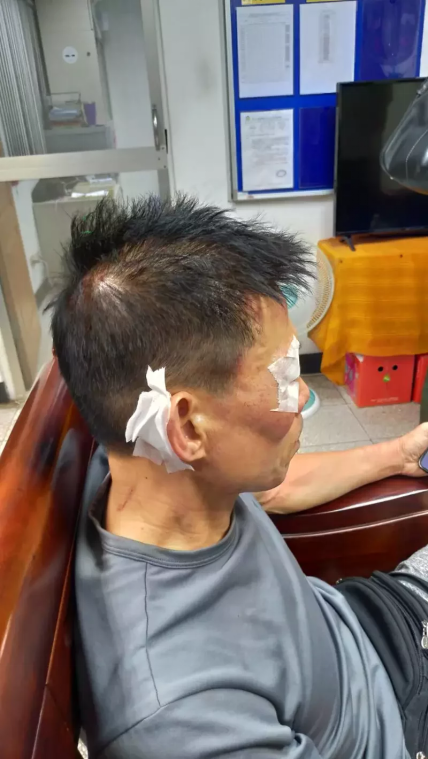 黄姓男子被警察误认为通缉犯,强制上铐过程中受伤。(图片来源:台湾《联合报》)