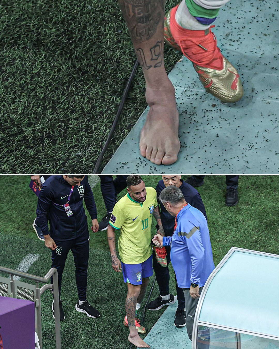世界杯小组赛首场巴西队2：0击败塞尔维亚队的比赛中，内马尔脚踝受伤 图源：外媒