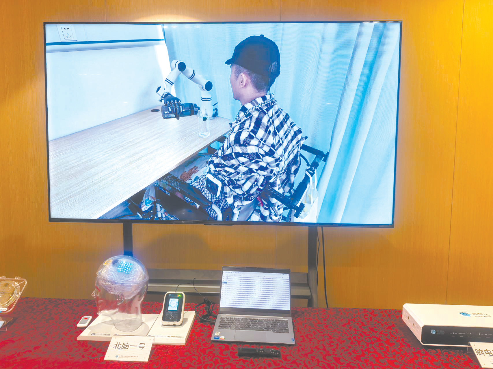 手术后的患者正通过“北脑一号”脑机接口控制机械臂