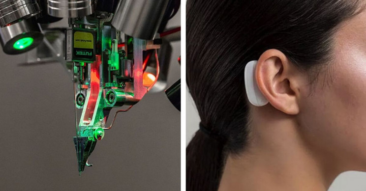 马斯克旗下初创公司neuralink研制的脑机接口技术及植入设备