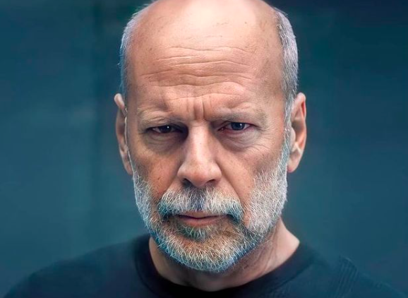 他是全世界最性感的秃头网友吵翻了