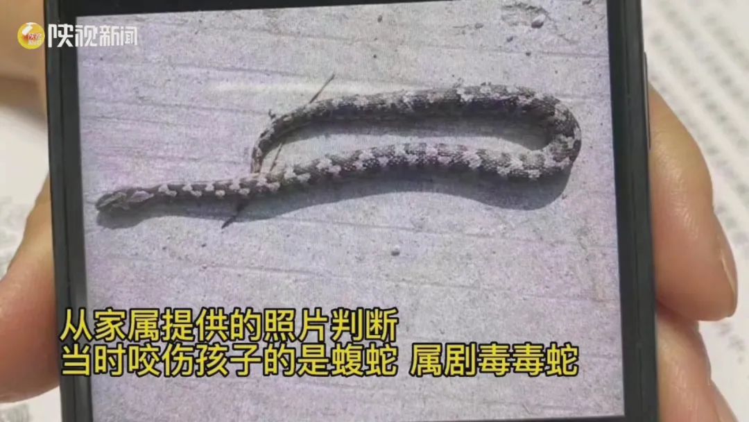 剧毒毒蛇钻进被窝咬伤3岁女童！医院紧急救治