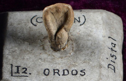 “河套人”牙齿模型（牙冠面）