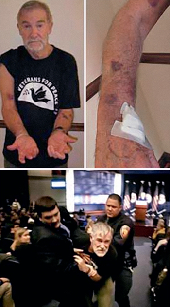 2011年2月15日，麦戈文因抗议被警方抓走，胳膊被打出好几块淤青。