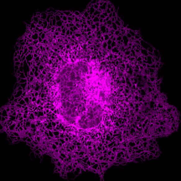 先进光学显微成像显示单个细胞内部的内质网