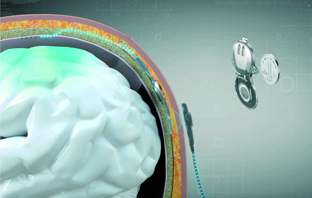 专访清华大学脑机接口科研团队负责人中美脑机接口下一突破是什么