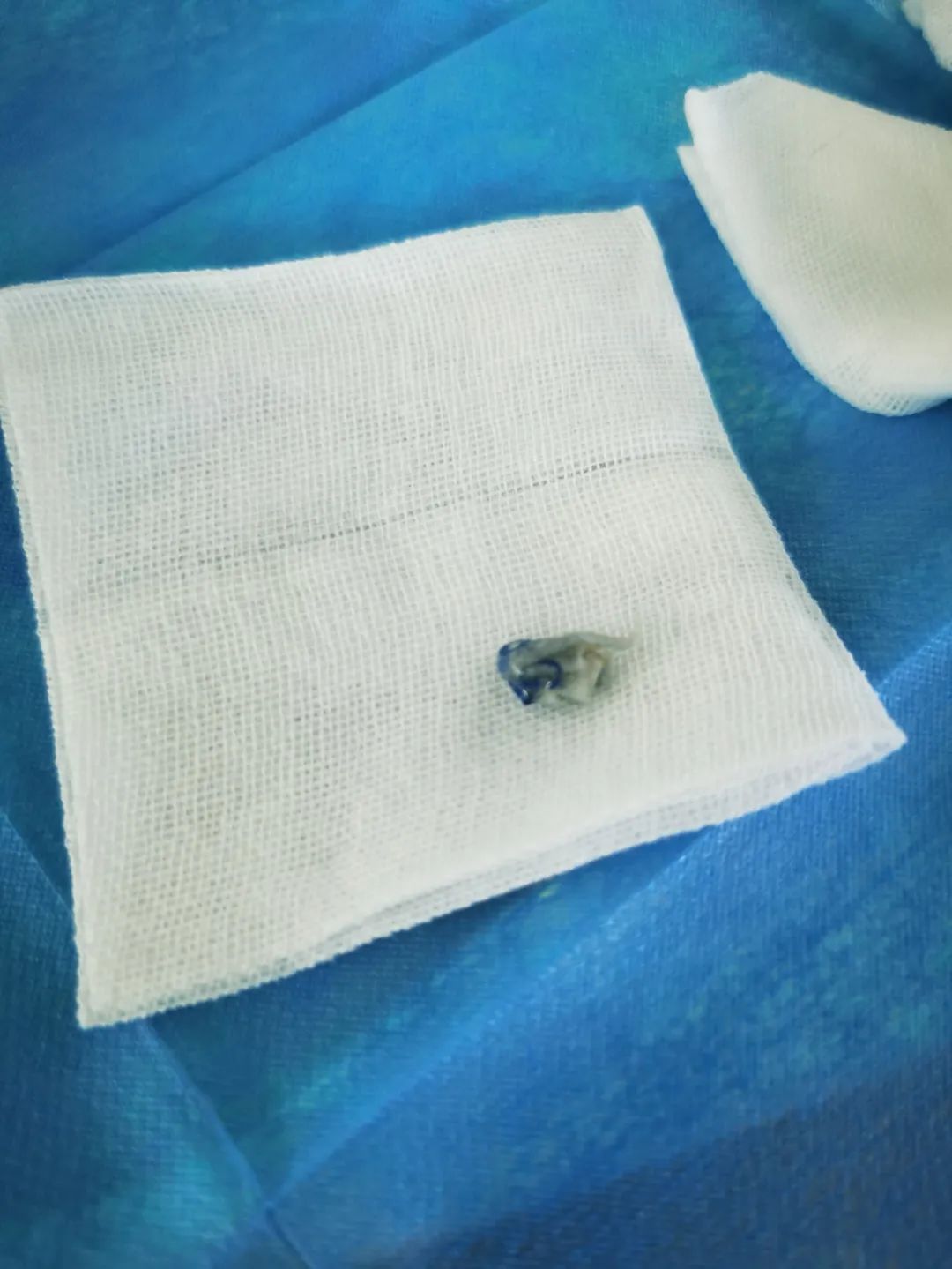 加强看护避免孩子误吞异物此时,医护人员紧张的心情才放松下来,再一看