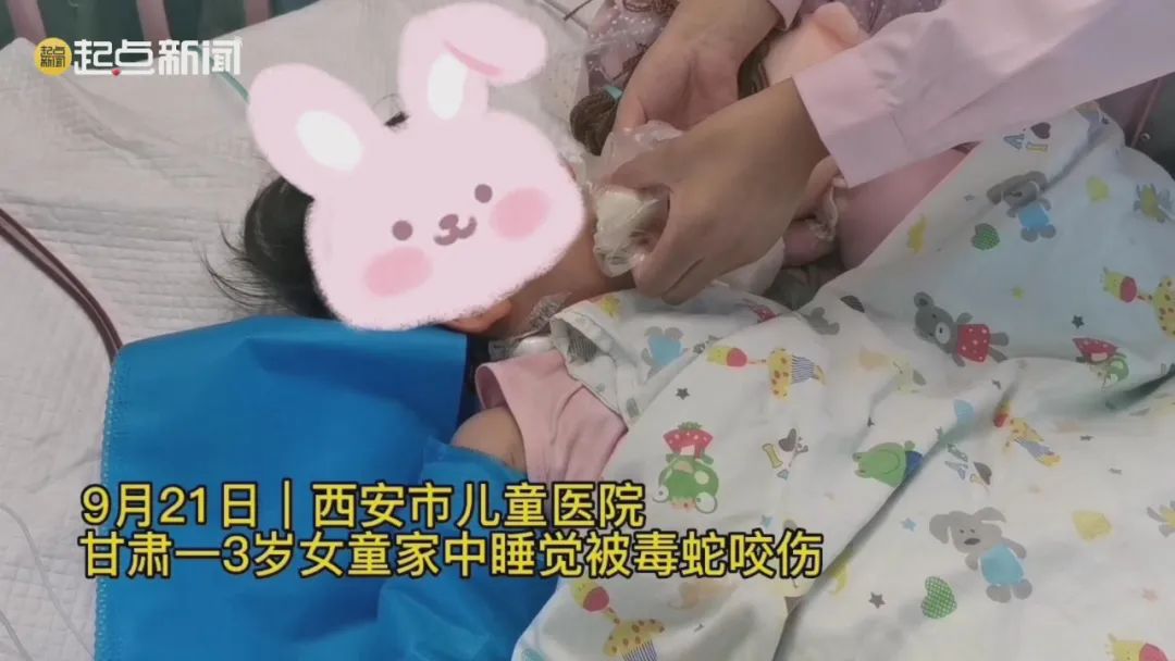 剧毒毒蛇钻进被窝咬伤3岁女童！医院紧急救治