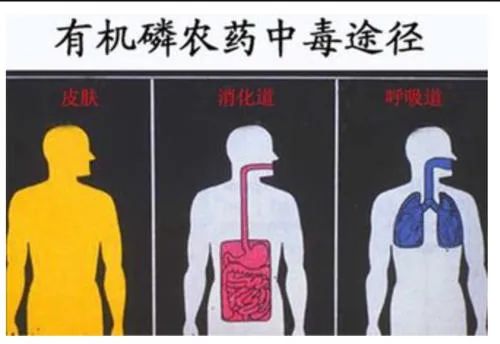 甲基异柳磷中毒图片