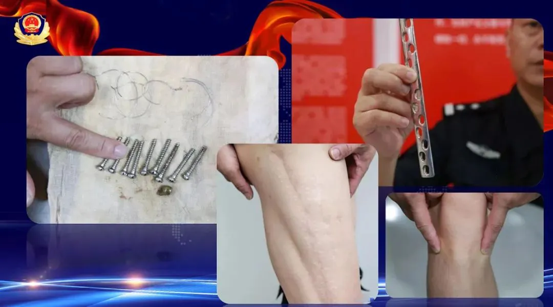 1处枪伤、11处刀疤、142针挡不住他的决心!