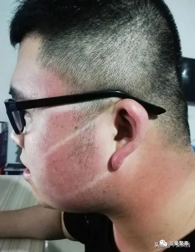 西安交警被晒成"口罩脸" ! 网友:最美"烙印"让人心疼!